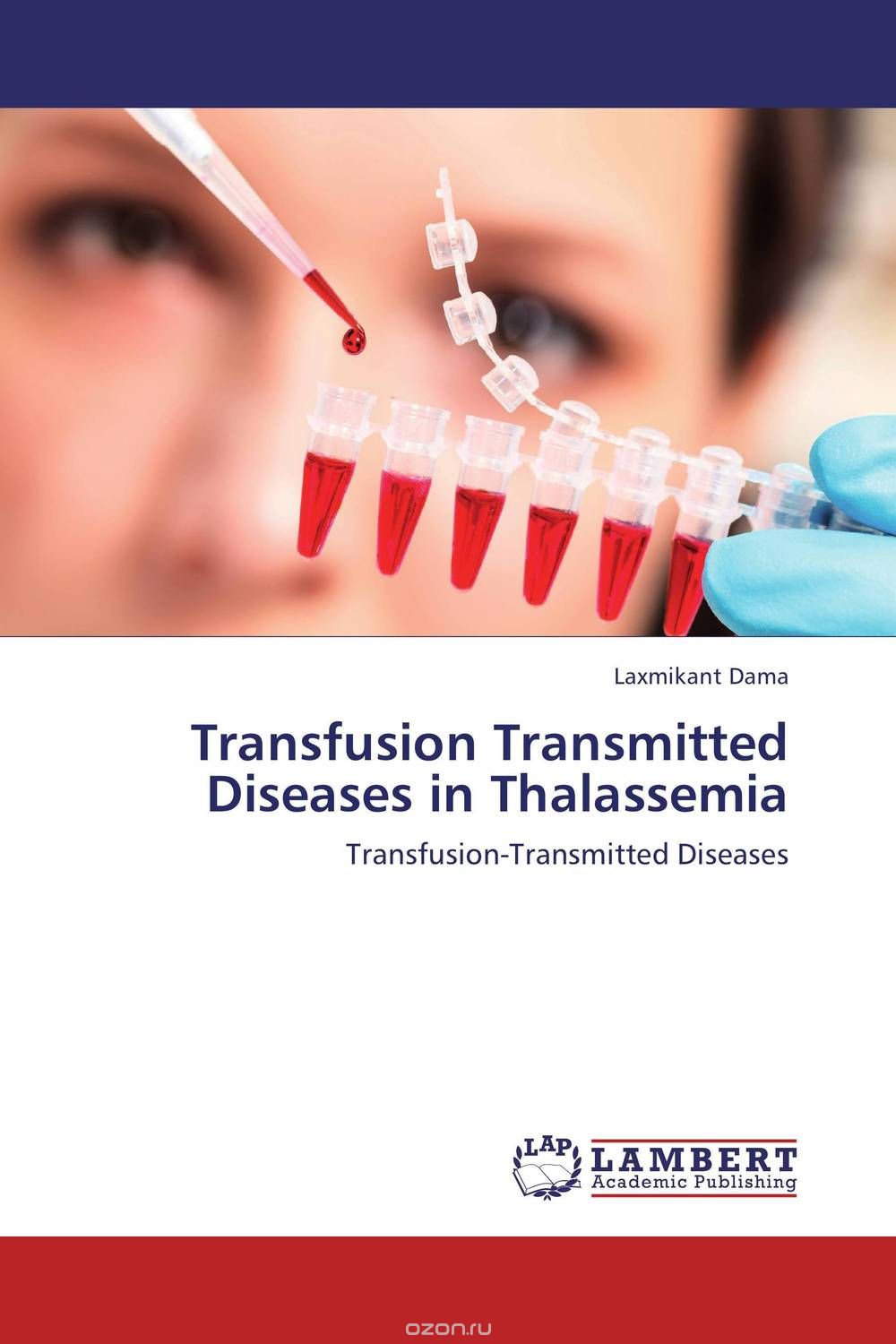 Скачать книгу "Transfusion Transmitted Diseases in Thalassemia"
