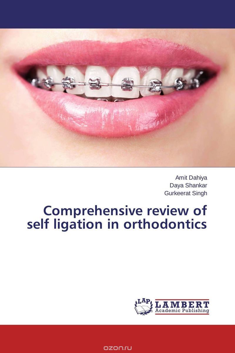 Скачать книгу "Comprehensive review of self ligation in orthodontics"