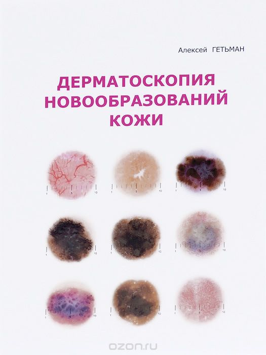 Скачать книгу "Дерматоскопия новообразований кожи, Алексей Гетьман"