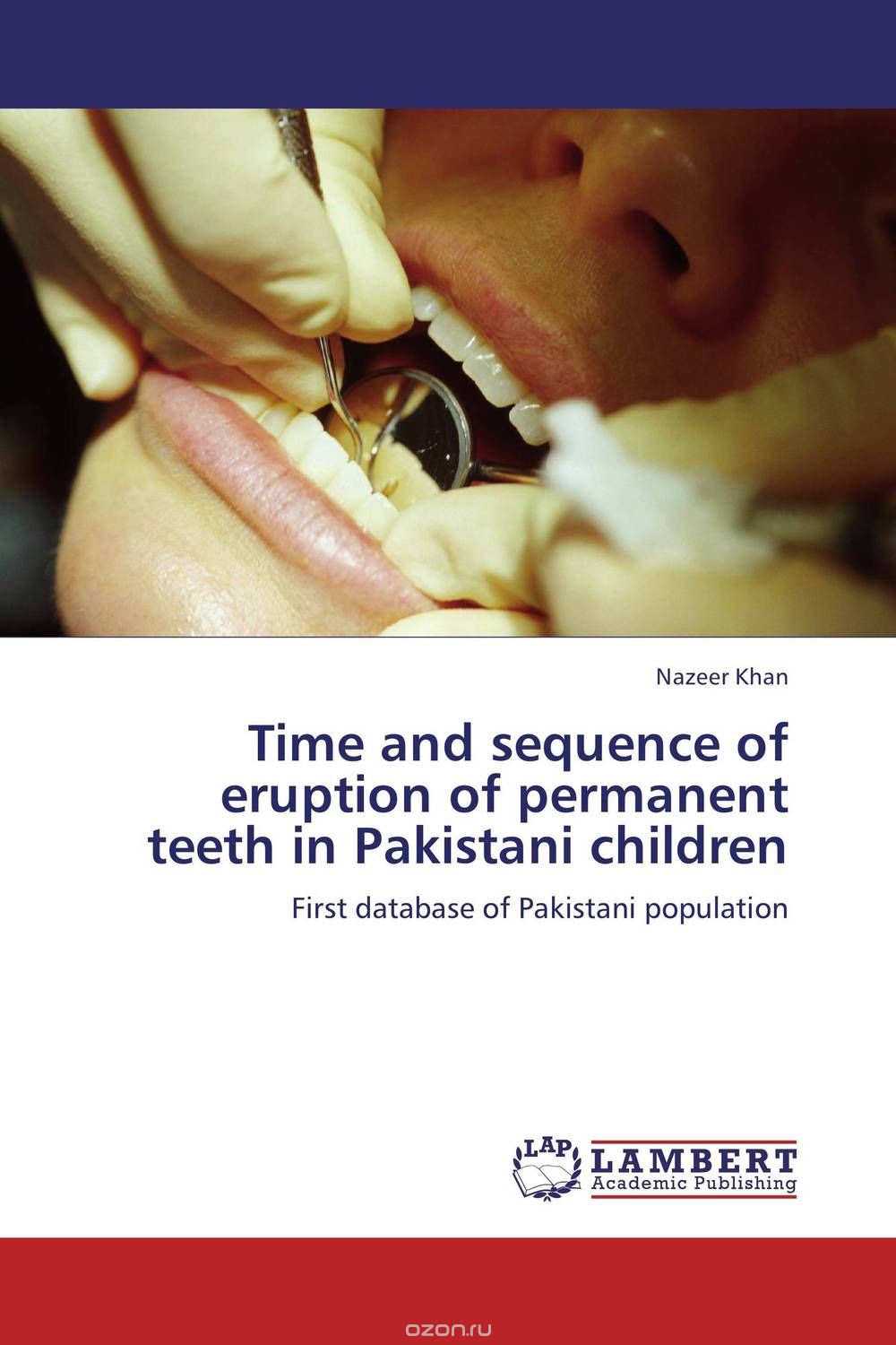 Time and sequence of eruption of permanent teeth in Pakistani children