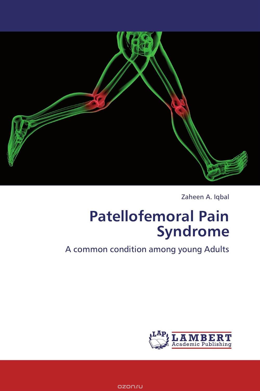 Скачать книгу "Patellofemoral Pain Syndrome"