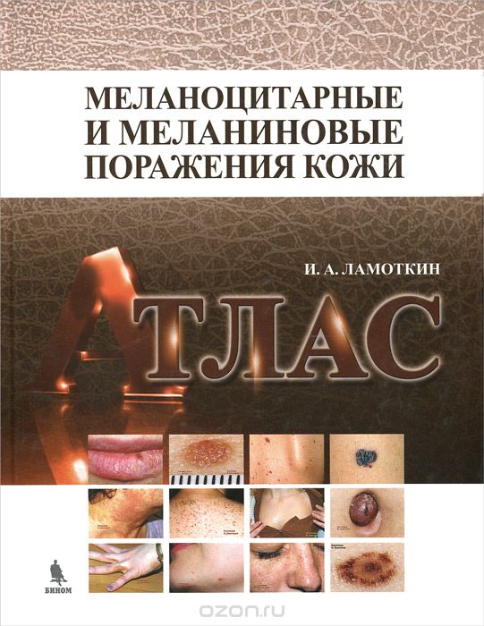Скачать книгу "Меланоцитарные и меланиновые поражения кожи. Атлас. Учебное пособие, И. А. Ламоткин"