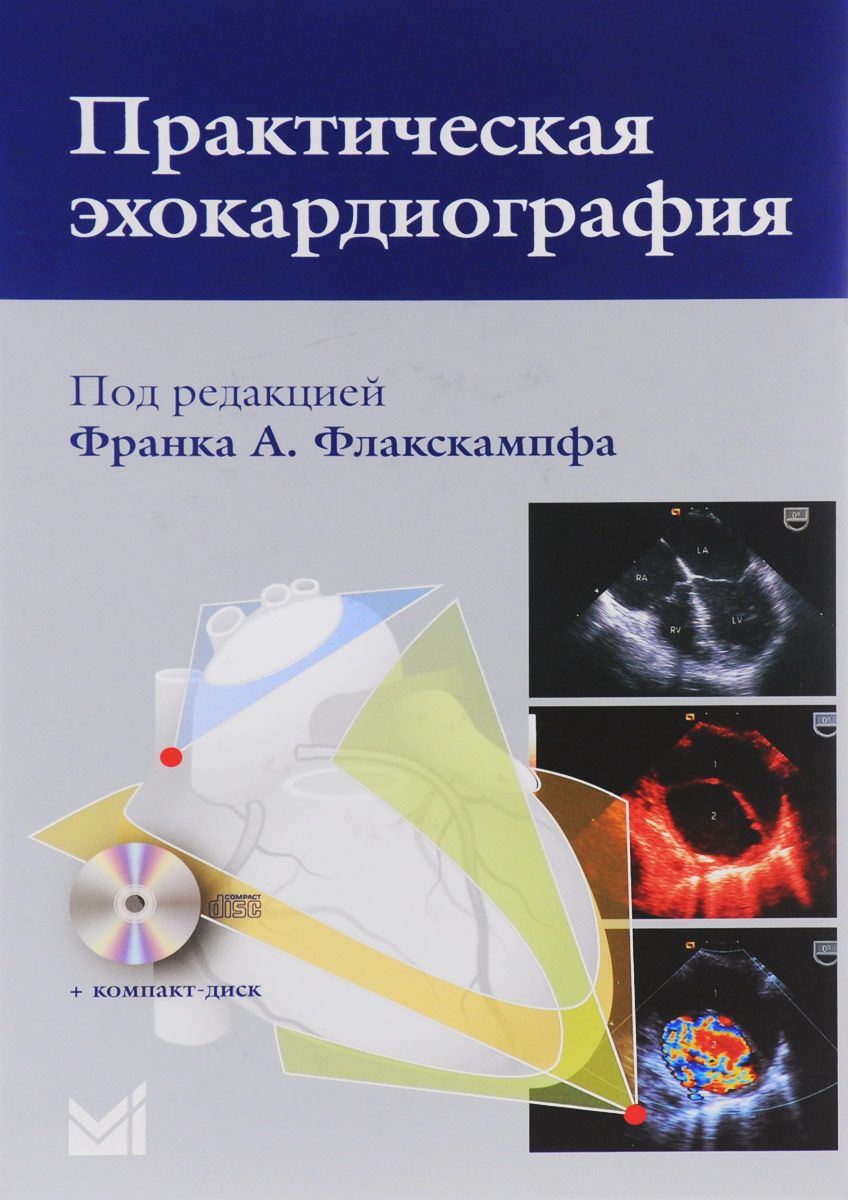 Скачать книгу "Практическая эхокардиография. Руководство по эхокардиографической диагностике (+ CD)"